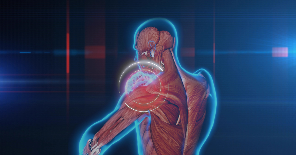 Optimizing Shoulder Function: Advances in Assessment, Rehabilitation, and Performance